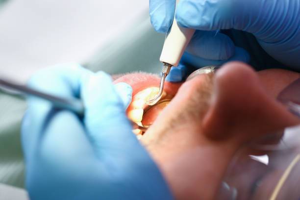 Best Emergency Care for Gum Disease in St Bernard, OH